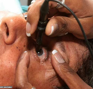 Só em 2011, médicos cubanos recuperaram a visão gratuitamente de2 milhões de pessoas em 35 países