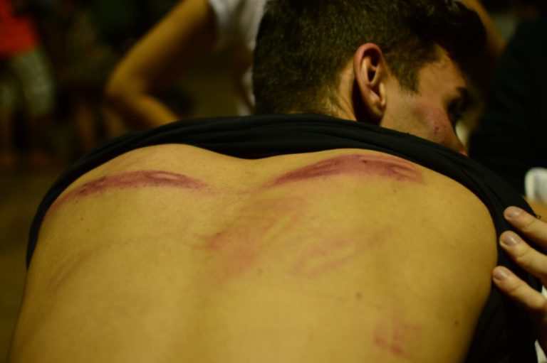 Militante da UJR é torturado pela polícia de Temer durante manifestação contra a PEC 55